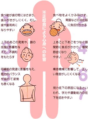 噛み合わせの悪さから生じる負担